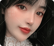眼綜合手術(shù)